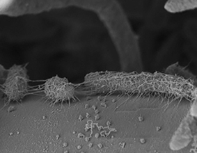 Bacterial Attack on Fungal Hyphae