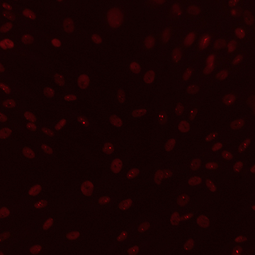 nuclei