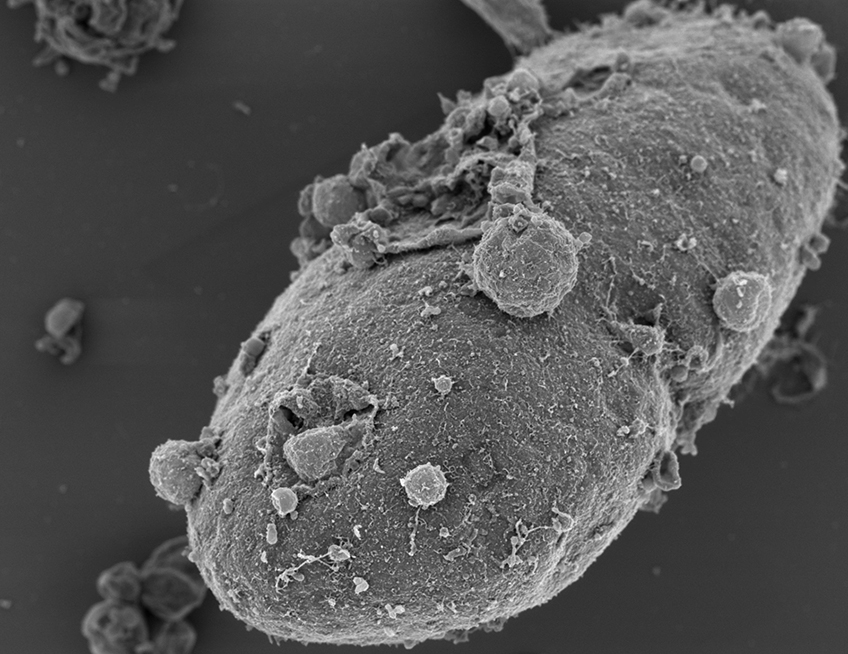 Exposed Nucleus from a Patient Derived Fibroblast