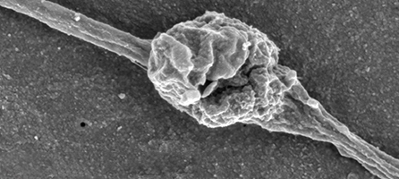 Synapse